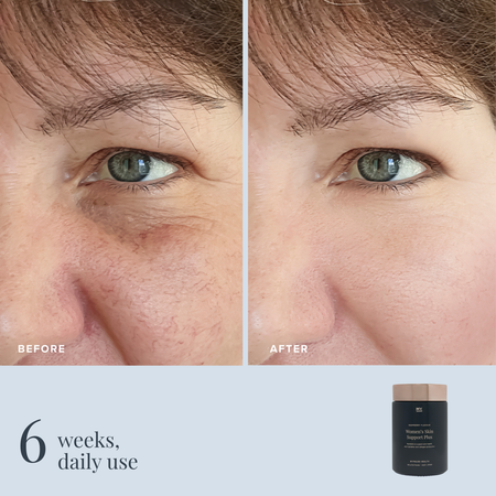 Women's Skin Support Plus