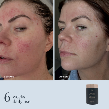 Women's Skin Support Plus