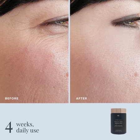 Women's Skin Support Plus