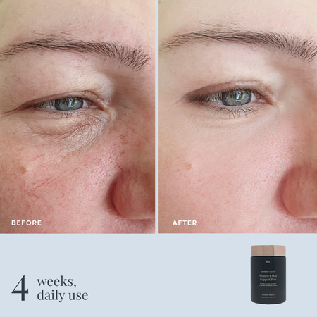 Women's Skin Support Plus