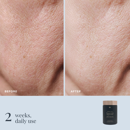 Women's Skin Support Plus