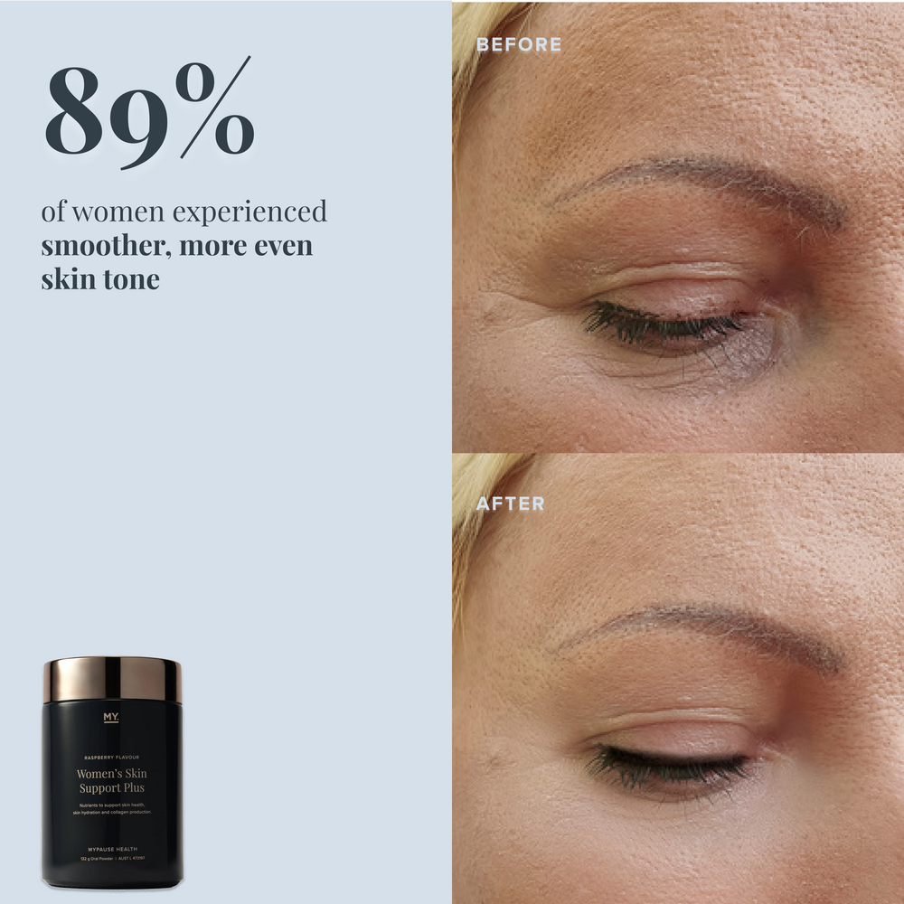 Women's Skin Support Plus