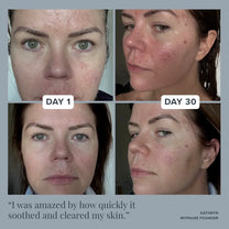 Women's Skin Support Plus